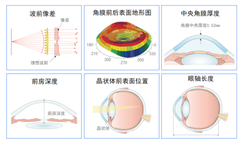 全光塑手术原理图