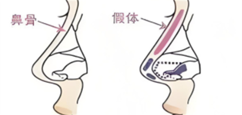 成都做鼻子出名的医院都是哪几家？成都现代、铜雀台整形医院的鼻整形术大PK！