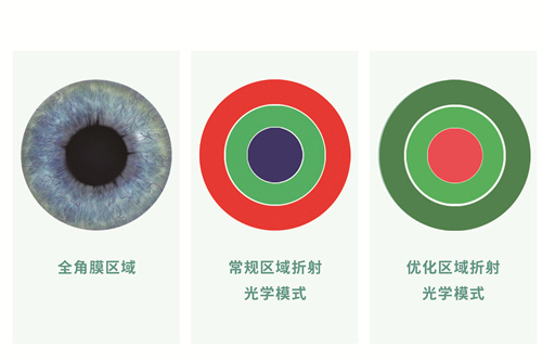 金视青春之光手术和其他手术作用区