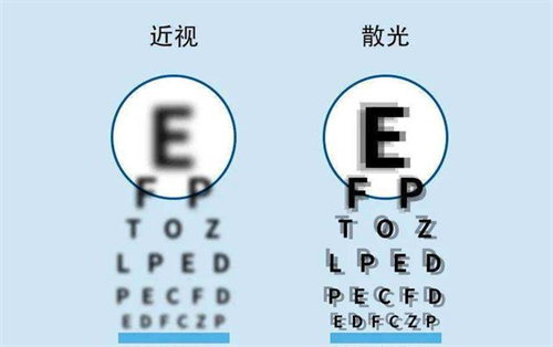 近视眼镜和散光的区别